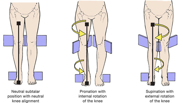 A diagram showing the different stages of a patient's leg.